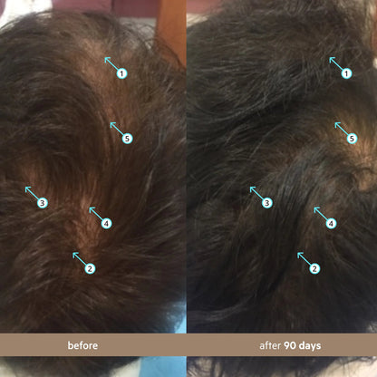 🏅AQANanoxidil 5% Hair Growth Serum for Thicker, Fuller Hair☘️